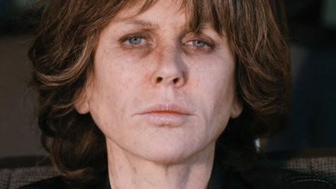 Nicole Kidman felismerhetetlenné lett csúfítva az új filmjében
