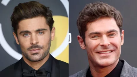 Kiderült, miért változott meg Zac Efron arca olyan drasztikusan