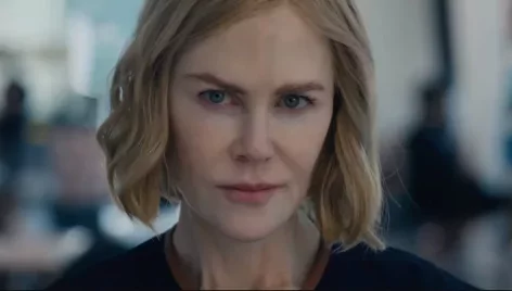 Egyre borzalmasabb Nicole Kidman arca