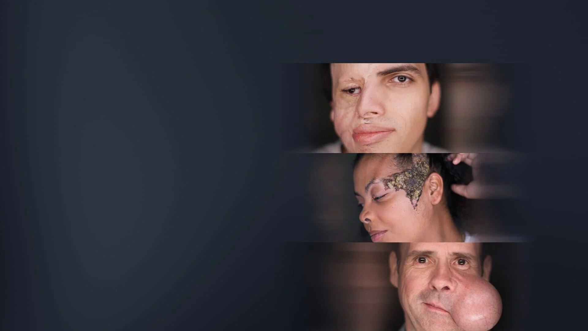 Arc átalakítók || Daganatok mindenütt